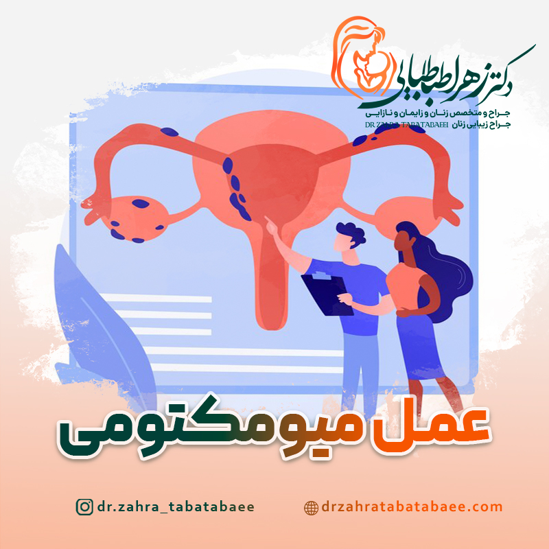 عمل میومکتومی در شیراز